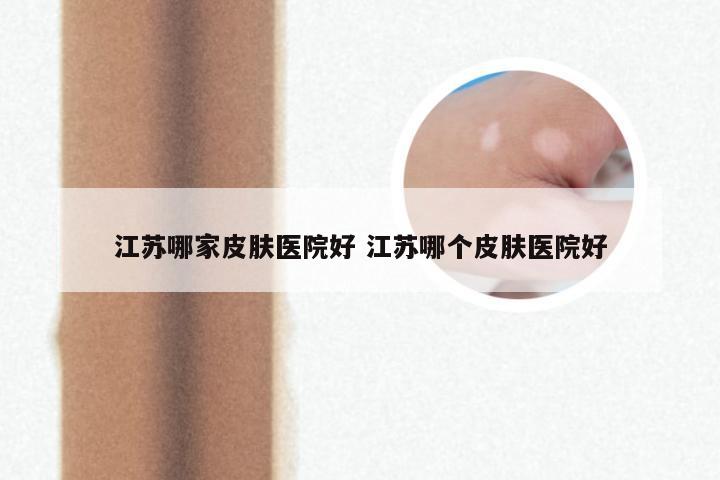 江苏哪家皮肤医院好 江苏哪个皮肤医院好