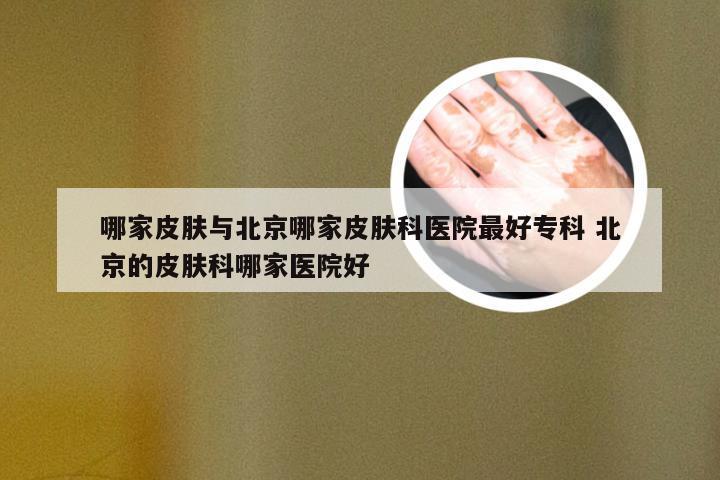哪家皮肤与北京哪家皮肤科医院最好专科 北京的皮肤科哪家医院好