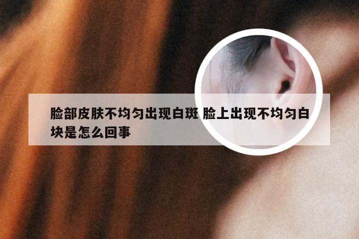 脸部皮肤不均匀出现白斑 脸上出现不均匀白块是怎么回事