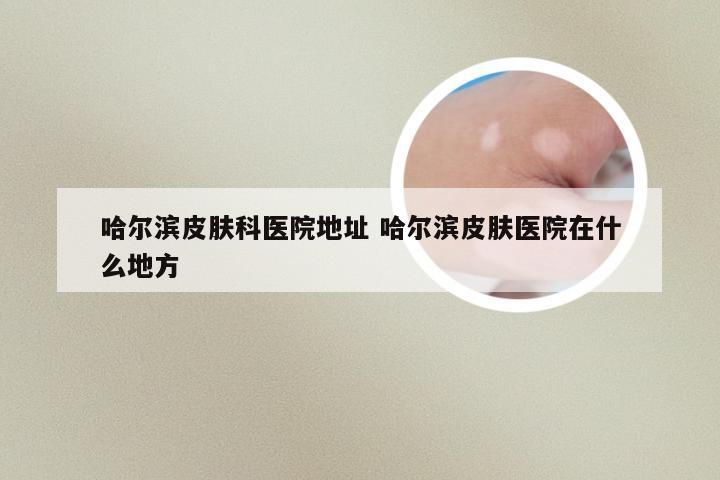哈尔滨皮肤科医院地址 哈尔滨皮肤医院在什么地方