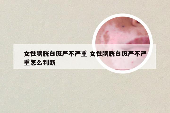 女性膀胱白斑严不严重 女性膀胱白斑严不严重怎么判断
