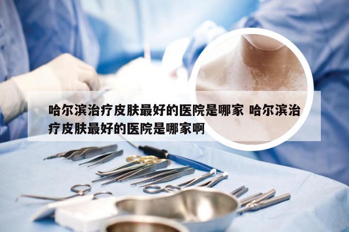 哈尔滨治疗皮肤最好的医院是哪家 哈尔滨治疗皮肤最好的医院是哪家啊