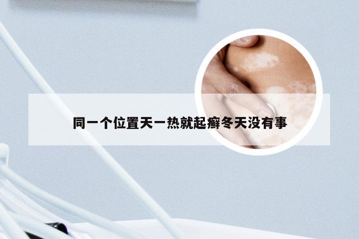 同一个位置天一热就起癣冬天没有事