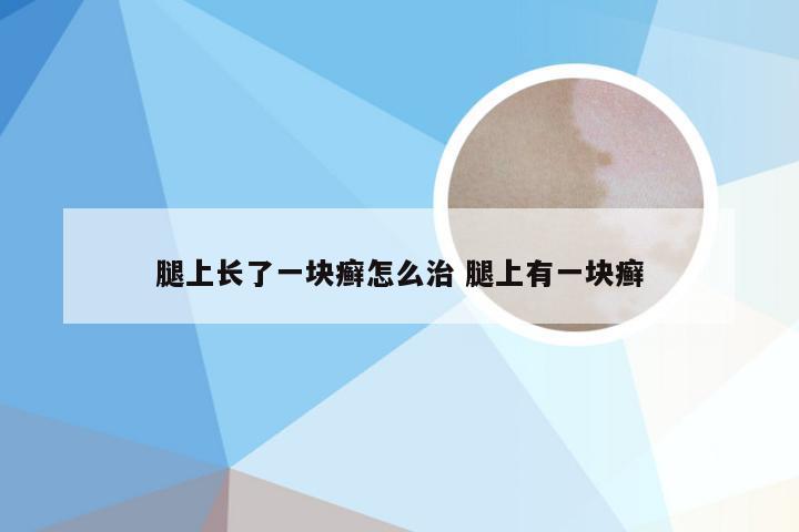 腿上长了一块癣怎么治 腿上有一块癣