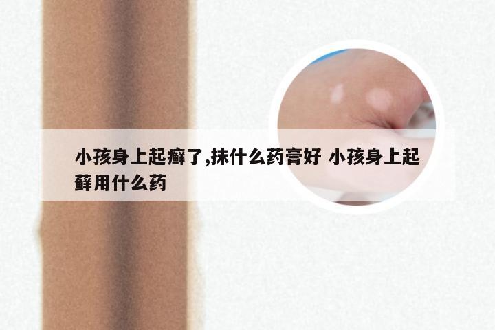 小孩身上起癣了,抹什么药膏好 小孩身上起藓用什么药