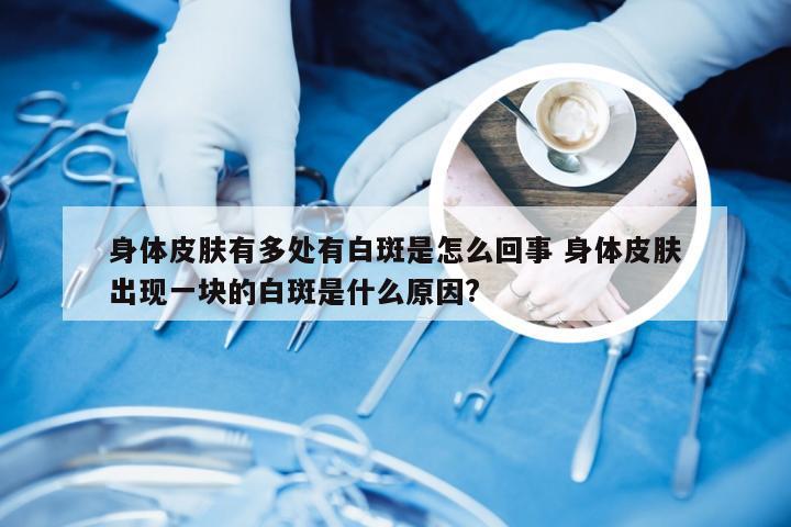 身体皮肤有多处有白斑是怎么回事 身体皮肤出现一块的白斑是什么原因?