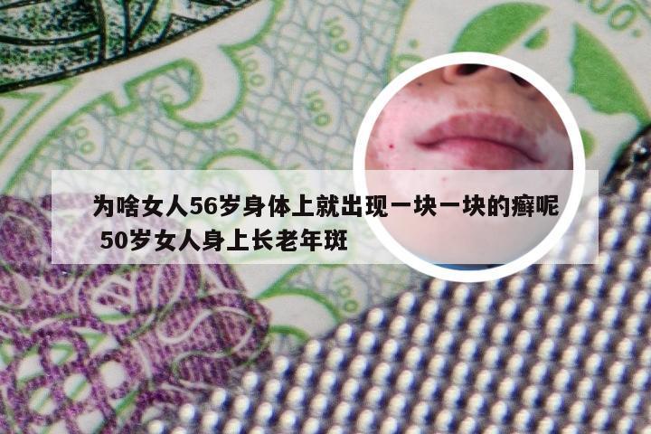 为啥女人56岁身体上就出现一块一块的癣呢 50岁女人身上长老年斑