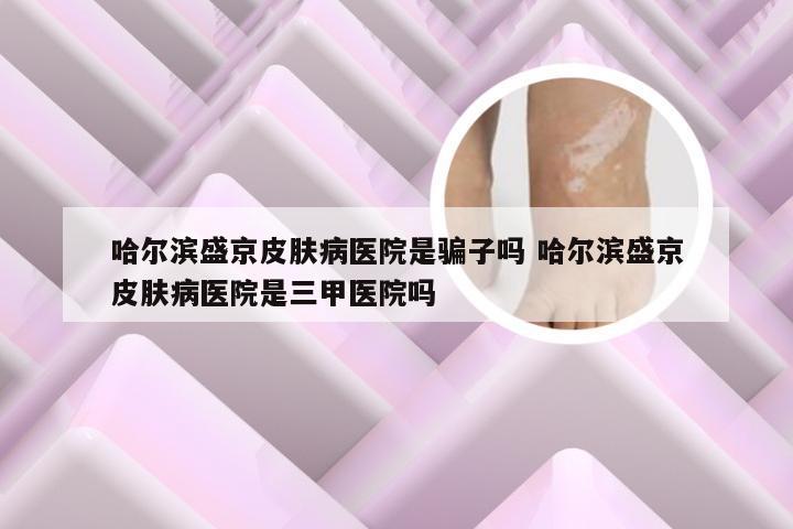 哈尔滨盛京皮肤病医院是骗子吗 哈尔滨盛京皮肤病医院是三甲医院吗