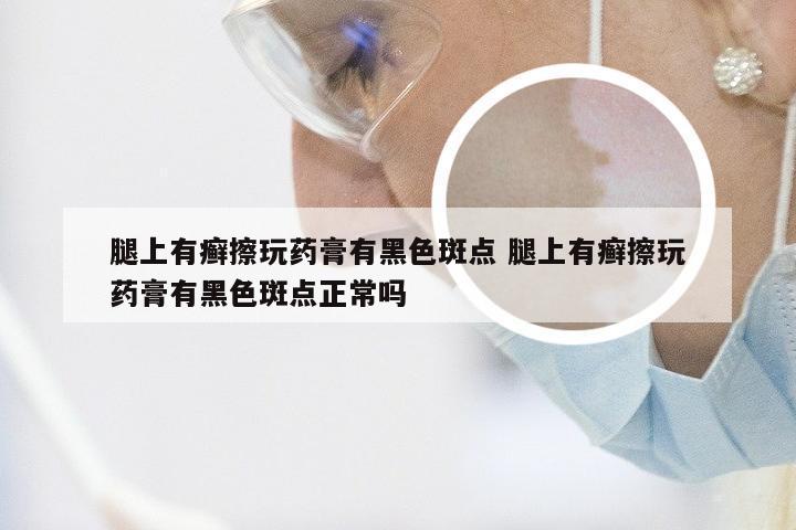 腿上有癣擦玩药膏有黑色斑点 腿上有癣擦玩药膏有黑色斑点正常吗