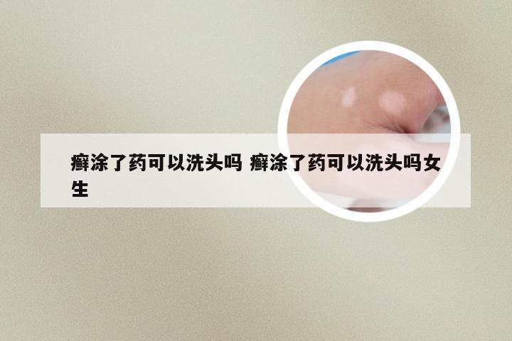 癣涂了药可以洗头吗 癣涂了药可以洗头吗女生
