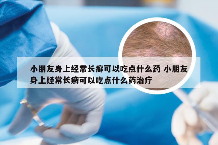 小朋友身上经常长癣可以吃点什么药 小朋友身上经常长癣可以吃点什么药治疗