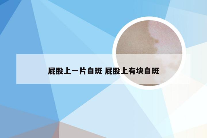 屁股上一片白斑 屁股上有块白斑