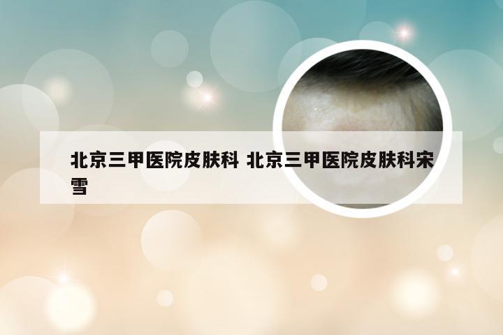 北京三甲医院皮肤科 北京三甲医院皮肤科宋雪