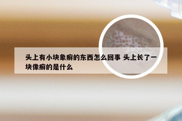 头上有小块象癣的东西怎么回事 头上长了一块像癣的是什么