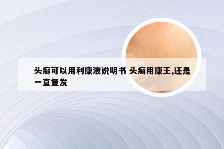 头癣可以用利康液说明书 头癣用康王,还是一直复发