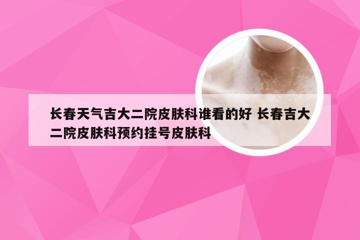 长春天气吉大二院皮肤科谁看的好 长春吉大二院皮肤科预约挂号皮肤科