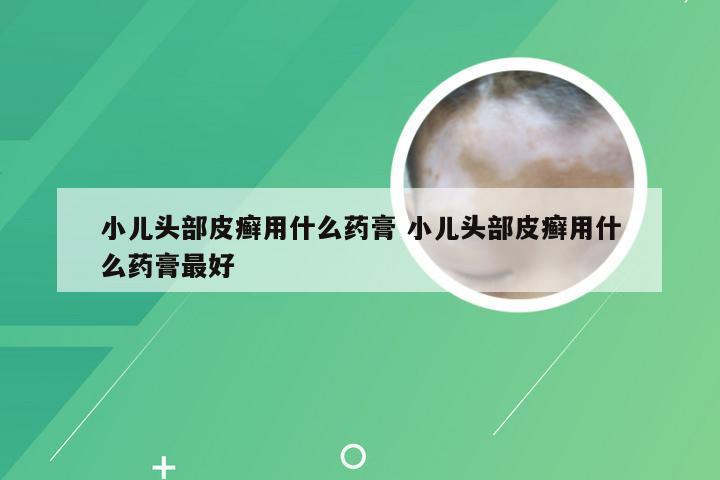小儿头部皮癣用什么药膏 小儿头部皮癣用什么药膏最好