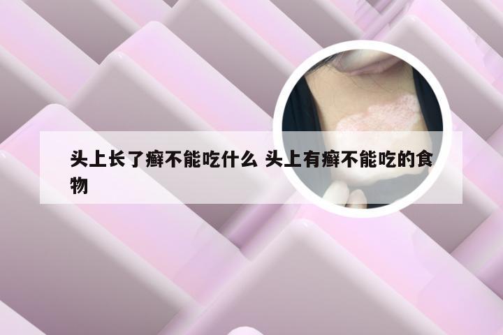 头上长了癣不能吃什么 头上有癣不能吃的食物