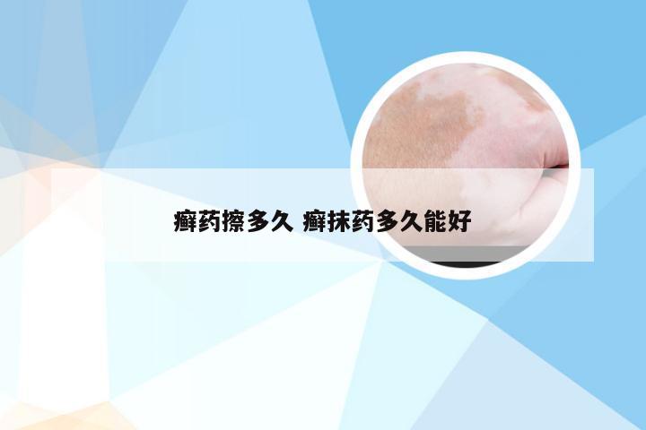 癣药擦多久 癣抹药多久能好