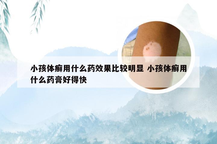 小孩体癣用什么药效果比较明显 小孩体癣用什么药膏好得快