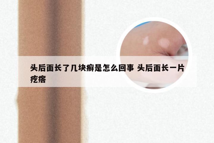 头后面长了几块癣是怎么回事 头后面长一片疙瘩