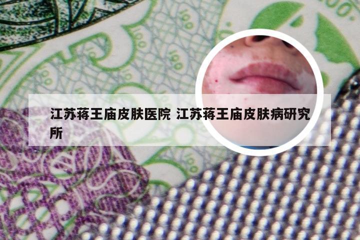 江苏蒋王庙皮肤医院 江苏蒋王庙皮肤病研究所