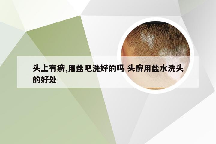 头上有癣,用盐吧洗好的吗 头癣用盐水洗头的好处