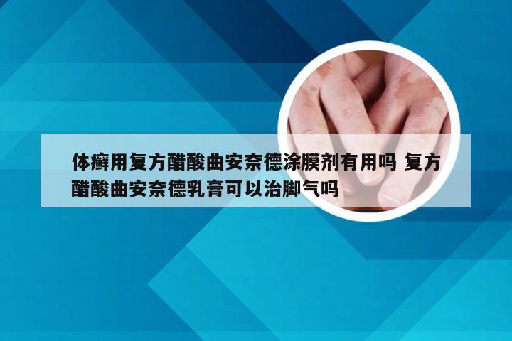 体癣用复方醋酸曲安奈德涂膜剂有用吗 复方醋酸曲安奈德乳膏可以治脚气吗