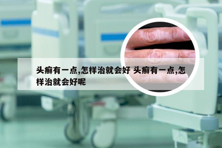 头癣有一点,怎样治就会好 头癣有一点,怎样治就会好呢