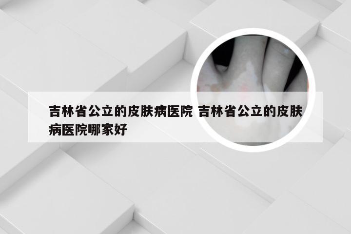吉林省公立的皮肤病医院 吉林省公立的皮肤病医院哪家好