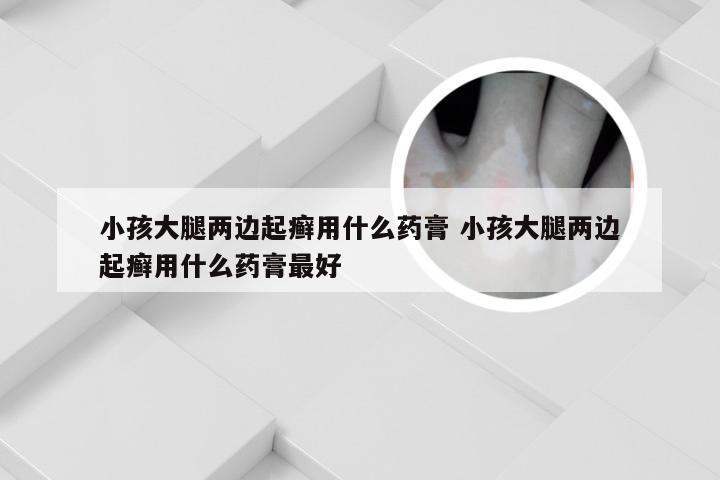 小孩大腿两边起癣用什么药膏 小孩大腿两边起癣用什么药膏最好