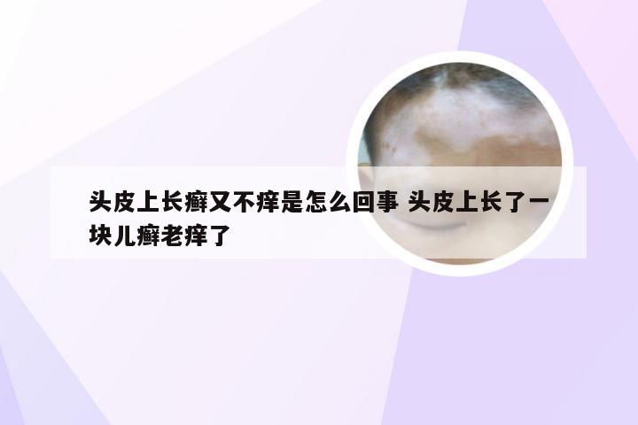 头皮上长癣又不痒是怎么回事 头皮上长了一块儿癣老痒了