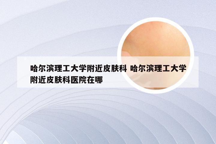 哈尔滨理工大学附近皮肤科 哈尔滨理工大学附近皮肤科医院在哪