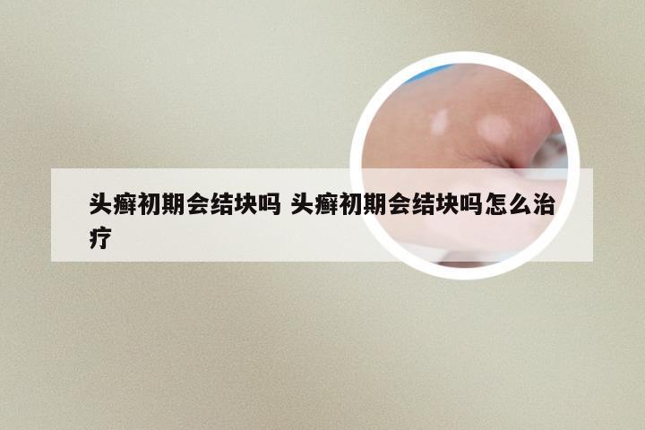 头癣初期会结块吗 头癣初期会结块吗怎么治疗