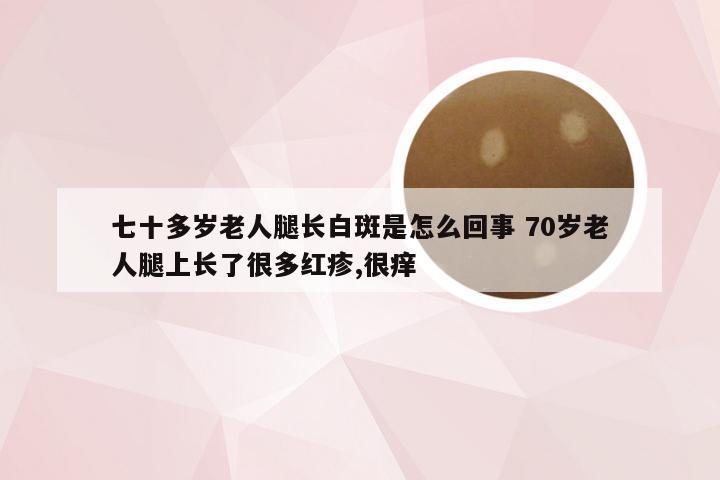 七十多岁老人腿长白斑是怎么回事 70岁老人腿上长了很多红疹,很痒