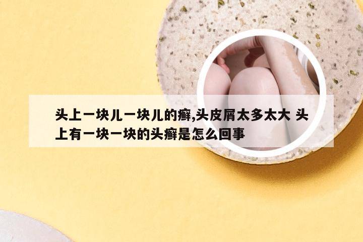 头上一块儿一块儿的癣,头皮屑太多太大 头上有一块一块的头癣是怎么回事