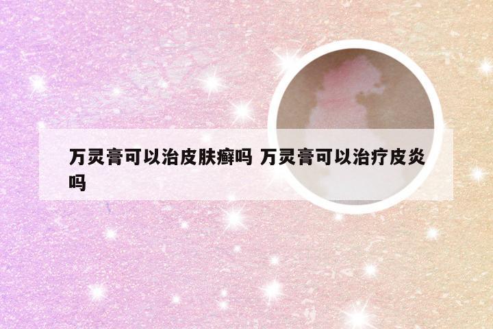 万灵膏可以治皮肤癣吗 万灵膏可以治疗皮炎吗