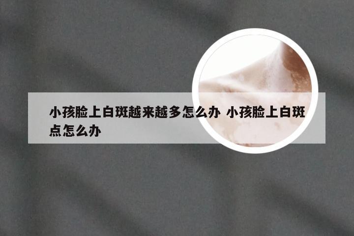 小孩脸上白斑越来越多怎么办 小孩脸上白斑点怎么办