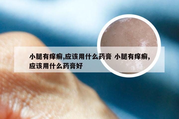 小腿有痒癣,应该用什么药膏 小腿有痒癣,应该用什么药膏好