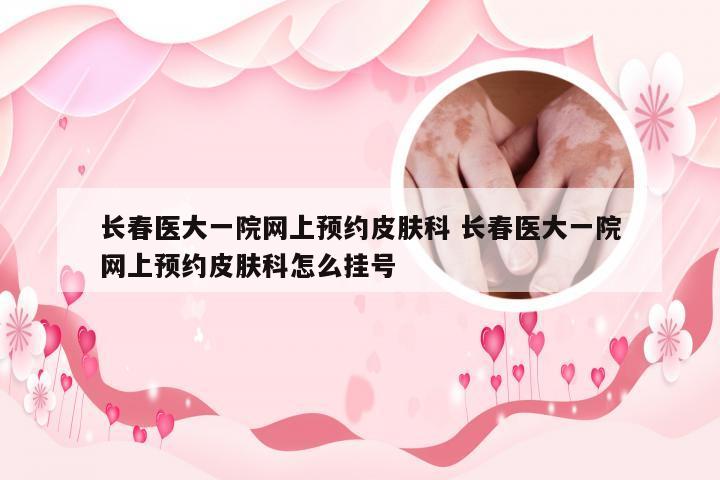 长春医大一院网上预约皮肤科 长春医大一院网上预约皮肤科怎么挂号