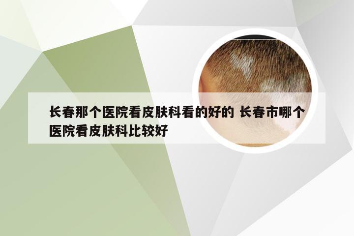 长春那个医院看皮肤科看的好的 长春市哪个医院看皮肤科比较好
