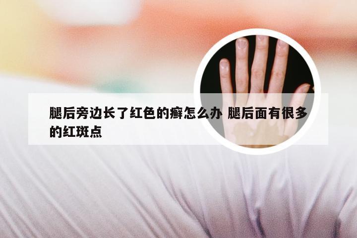 腿后旁边长了红色的癣怎么办 腿后面有很多的红斑点