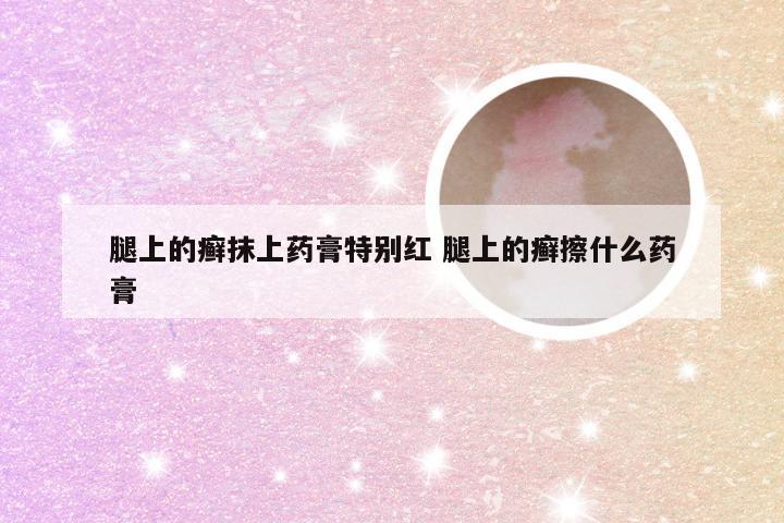 腿上的癣抹上药膏特别红 腿上的癣擦什么药膏
