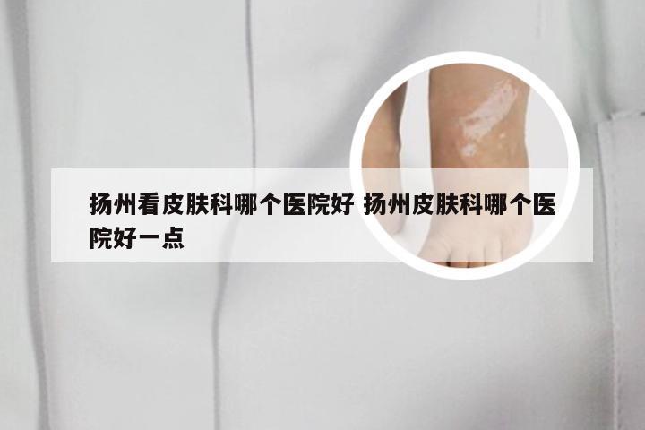 扬州看皮肤科哪个医院好 扬州皮肤科哪个医院好一点