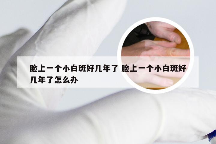 脸上一个小白斑好几年了 脸上一个小白斑好几年了怎么办