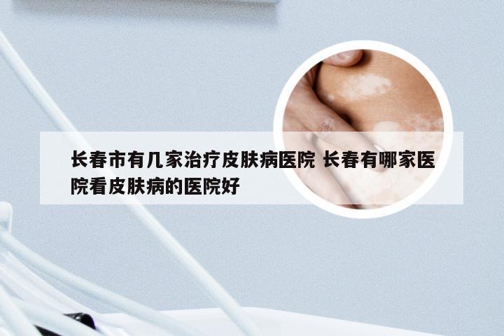 长春市有几家治疗皮肤病医院 长春有哪家医院看皮肤病的医院好