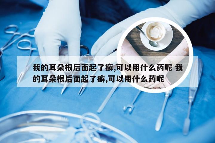 我的耳朵根后面起了癣,可以用什么药呢 我的耳朵根后面起了癣,可以用什么药呢