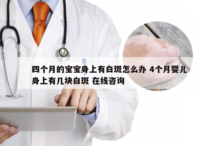 四个月的宝宝身上有白斑怎么办 4个月婴儿身上有几块白斑 在线咨询