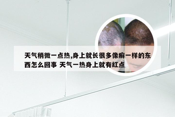 天气稍微一点热,身上就长很多像癣一样的东西怎么回事 天气一热身上就有红点