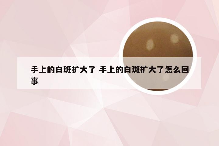 手上的白斑扩大了 手上的白斑扩大了怎么回事